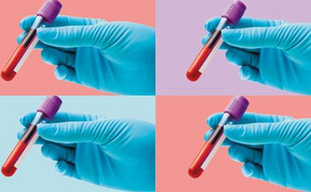 The Shifting Significance of Serial Serum Chemistries